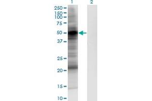 Western Blot analysis of PDPK1 expression in transfected 293T cell line by PDPK1 monoclonal antibody (M05), clone 2E2. (PDPK1 antibody  (AA 457-556))