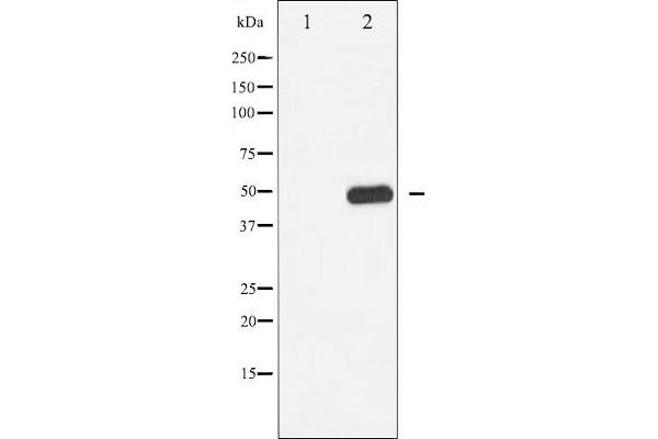 CAMK2B anticorps  (pThr286)