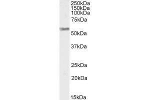 Western Blotting (WB) image for anti-Solute Carrier Family 18 (Vesicular Monoamine Transporter), Member 2 (SLC18A2) (C-Term) antibody (ABIN570915)