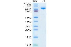 FAP Protein (His-Avi Tag,Biotin)