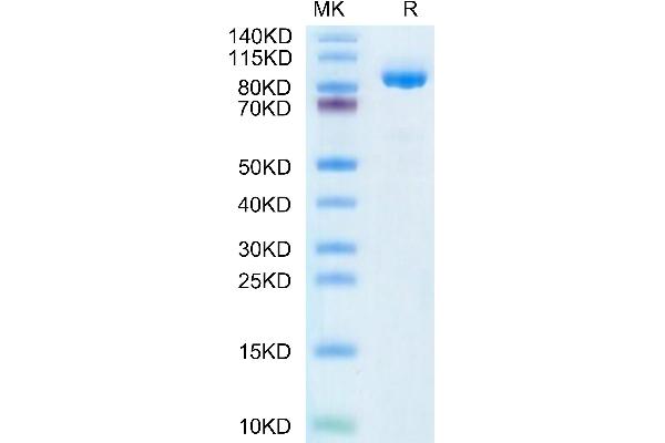 FAP Protein (His-Avi Tag,Biotin)