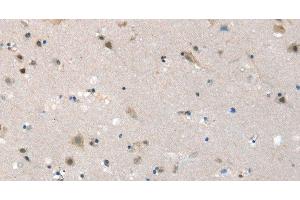 SLC6A7 antibody