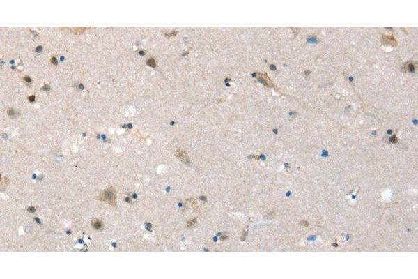 SLC6A7 antibody