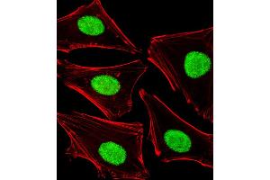 Fluorescent image of Hela cells stained with POLDIP3 Antibody (N-term).