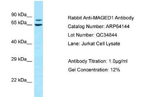 Western Blotting (WB) image for anti-Melanoma Antigen Family D, 1 (MAGED1) (C-Term) antibody (ABIN2789745) (MAGED1 antibody  (C-Term))