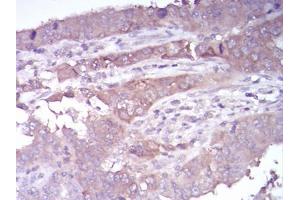 Immunohistochemistry (IHC) image for anti-Histone Deacetylase 4 (HDAC4) (AA 456-592) antibody (ABIN5542325)