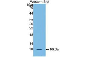 Western blot analysis of the recombinant protein. (IL-6 Receptor antibody  (AA 385-462))
