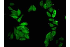 Immunofluorescent analysis of HepG2 cells using ABIN7147303 at dilution of 1:100 and Alexa Fluor 488-congugated AffiniPure Goat Anti-Rabbit IgG(H+L) (CDC23 antibody  (AA 62-142))