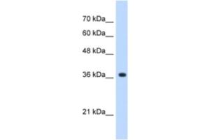 Western Blotting (WB) image for anti-alpha-1,4-N-Acetylglucosaminyltransferase (A4GNT) antibody (ABIN2463051)