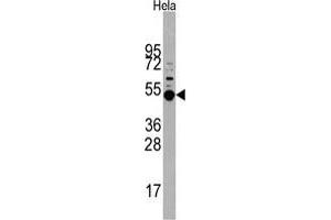 Western blot analysis of MAPKAPK5 Antibody in Hela cell line lysates (35 µg/lane). (MAPKAP Kinase 5 antibody  (Thr182))