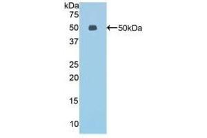 Detection of Recombinant ESM1, Mouse using Polyclonal Antibody to Endothelial Cell Specific Molecule 1 (ESM1) (ESM1 antibody  (AA 22-184))
