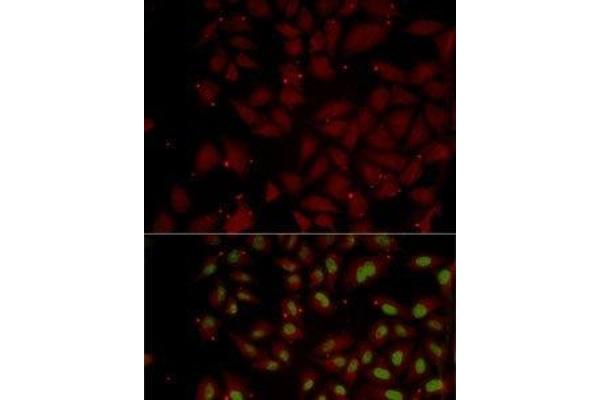 CCL25 antibody