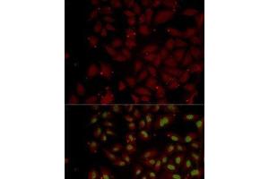 Immunofluorescence analysis of MCF7 cells using CCL25 Polyclonal Antibody (CCL25 antibody)