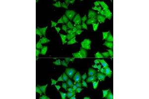 Immunofluorescence analysis of MCF7 cells using ACY1 Polyclonal Antibody (Aminoacylase 1 antibody)