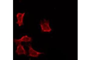 ABIN6276148 staining Hela by IF/ICC. (OR4C3 antibody  (Internal Region))