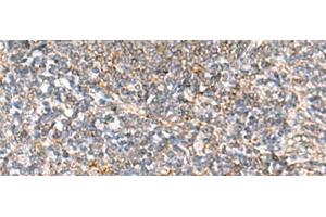 Immunohistochemistry of paraffin-embedded Human tonsil tissue using HLA-DOB Polyclonal Antibody at dilution of 1:40(x200) (HLA-DOB antibody)