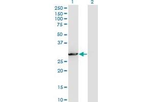 Western Blot analysis of PCSK1N expression in transfected 293T cell line by PCSK1N monoclonal antibody (M02), clone 1E9. (PCSK1N antibody  (AA 173-260))