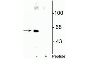 Western blot of HeLa cell lysate showing specific immunolabeling of the ~66 kDa Che-1 protein phosphorylated at Ser477 in the first lane (-). (AATF antibody  (pSer477))