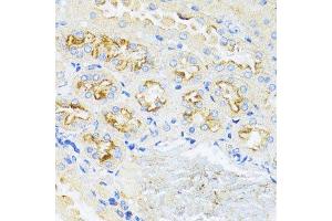 Immunohistochemistry (Paraffin-embedded Sections) (IHC (p)) image for anti-Cyclin D1 (CCND1) (C-Term) antibody (ABIN6138080)