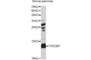 Western blot analysis of extracts of mouse pancreas, using TYROBP Antibody (ABIN5973118) at 1:3000 dilution. (TYROBP antibody)