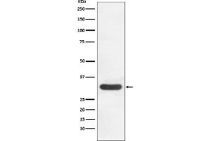 Western blot analysis of CDK4 expression in HeLa cell lysate. (Recombinant CDK4 antibody)