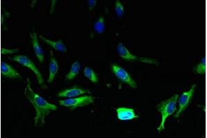 Immunofluorescent analysis of Hela cells using ABIN7144885 at dilution of 1:100 and Alexa Fluor 488-congugated AffiniPure Goat Anti-Rabbit IgG(H+L) (ABCA9 antibody  (AA 106-220))