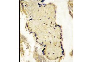Formalin-fixed and paraffin-embedded placenta tissue reacted with SL2a Antibody (N-term) (ABIN390295 and ABIN2840733) , which was peroxidase-conjugated to the secondary antibody, followed by DAB staining. (SPPL2A antibody  (N-Term))