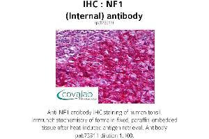 Image no. 1 for anti-Neurofibromin 1 (NF1) (Internal Region) antibody (ABIN1737327) (Neurofibromin 1 antibody  (Internal Region))