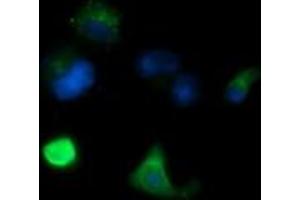 Image no. 2 for anti-Melan A (MLANA) antibody (ABIN1499427)