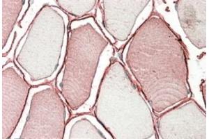 AP22425PU-N TRIM72 antibody staining of paraffin embedded Human Skeletal Muscle. (TRIM72 antibody  (Internal Region))