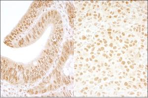 Immunohistochemistry (IHC) image for anti-Casein Kinase 2, beta (CSNK2B) (AA 100-150) antibody (ABIN7454541) (CSNK2B antibody  (AA 100-150))