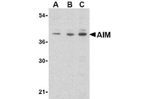 Image no. 1 for anti-CD5 Molecule-Like (CD5L) (N-Term) antibody (ABIN265123)