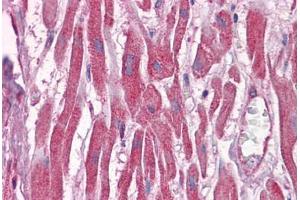 Human Heart: Formalin-Fixed, Paraffin-Embedded (FFPE) (DUSP6 antibody  (AA 1-382))