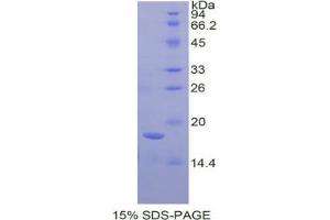 SDS-PAGE analysis of Human Amelogenin, X-Linked Protein.