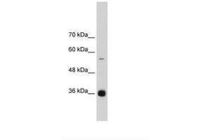 Image no. 3 for anti-Heterogeneous Nuclear Ribonucleoprotein A/B (HNRNPAB) (C-Term) antibody (ABIN203059) (HNRNPAB antibody  (C-Term))