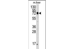 The anti-HS Pab (ABIN388133 and ABIN2846370) is used in Western blot to detect HS in mouse liver tissue lysate.