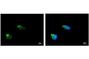 ICC/IF Image GALNT2 antibody [N1C1] detects GALNT2 protein at Golgi apparatus by immunofluorescent analysis.
