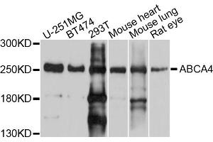Western blot analysis of extracts of various cell lines, using ABCA4 antibody (ABIN5997165) at 1/1000 dilution.