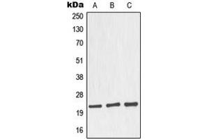 Western blot analysis of Nop30 expression in MCF7 (A), HeLa (B), mouse brain (C), rat brain (D) whole cell lysates.