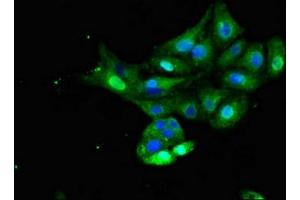 Immunofluorescent analysis of HepG2 cells using ABIN7156331 at dilution of 1:100 and Alexa Fluor 488-congugated AffiniPure Goat Anti-Rabbit IgG(H+L) (Insulin Receptor antibody  (AA 1023-1298))