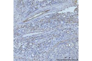 IHC analysis of CD93 using anti-CD93 antibody (ABIN7602865). (CD93 antibody  (C-Term))