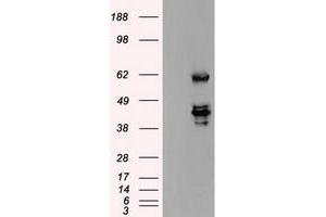 HEK293T cells were transfected with the pCMV6-ENTRY control (Left lane) or pCMV6-ENTRY SSB (Right lane) cDNA for 48 hrs and lysed. (SSB antibody)