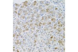 Immunohistochemistry of paraffin-embedded mouse stomach using HPS1 antibody. (HPS1 antibody)