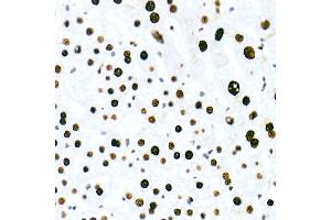 Immunohistochemistry of paraffin-embedded human liver using HNRNPM Rabbit mAb (ABIN7267635) at dilution of 1:100 (40x lens). (HNRNPM antibody)