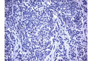 Image no. 2 for anti-Mdm2, p53 E3 Ubiquitin Protein Ligase Homolog (Mouse) (MDM2) (AA 119-438) antibody (ABIN1490872) (MDM2 antibody  (AA 119-438))