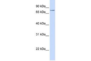 WB Suggested Anti-SYDE1  Antibody Titration: 0. (SYDE1 antibody  (C-Term))