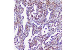 IHC analysis of RP2 using anti-RP2 antibody (ABIN6719513). (RP2 antibody  (AA 244-348))