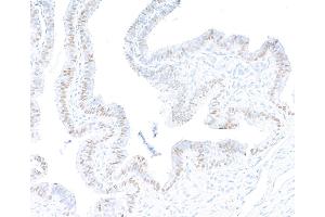 Immunohistochemistry (IHC) image for anti-Paired Box 8 (PAX8) (AA 225-275) antibody (ABIN7795777) (Recombinant PAX8 antibody  (AA 225-275))