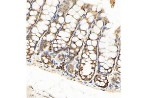 Immunohistochemistry of paraffin embedded mouse colon using SEC238 (ABIN7075521) at dilution of 1:650 (400x lens) (Sec23 Homolog B antibody)