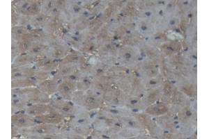 IHC-P analysis of Pig Cardiac Muscle Tissue, with DAB staining. (CKM antibody  (AA 11-367))